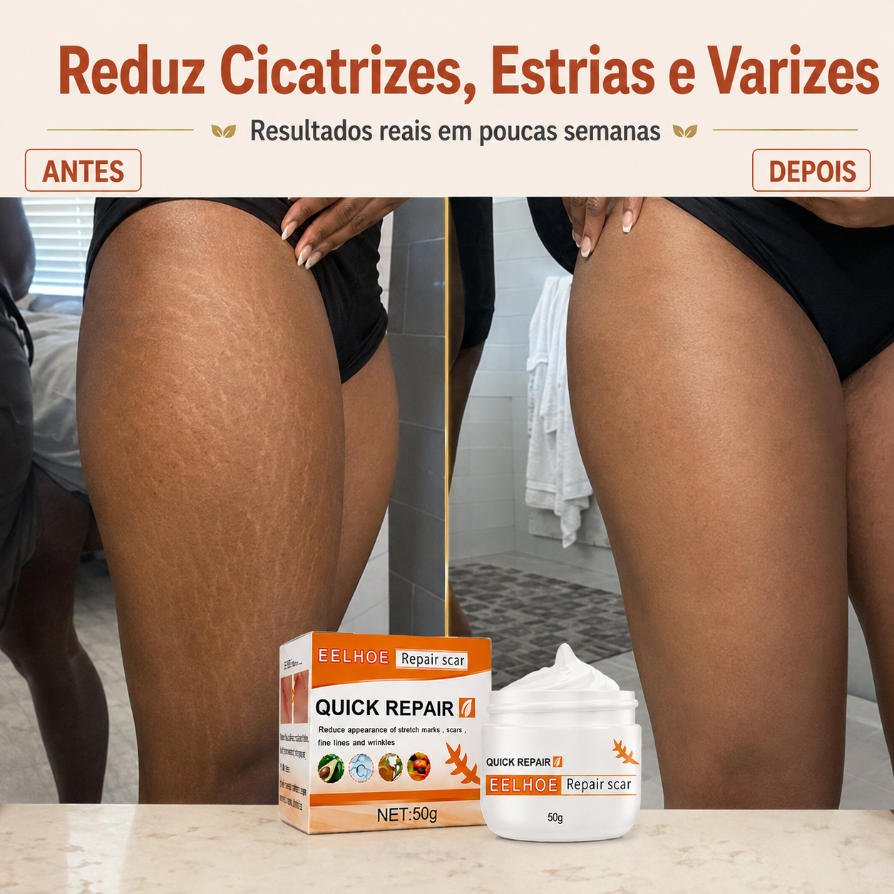 DermaRegen™ — Creme Regenerador de Pele para Cicatrizes, Estrias e Varizes