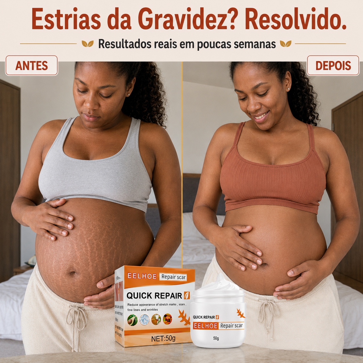 DermaRegen™ — Creme Regenerador de Pele para Cicatrizes, Estrias e Varizes