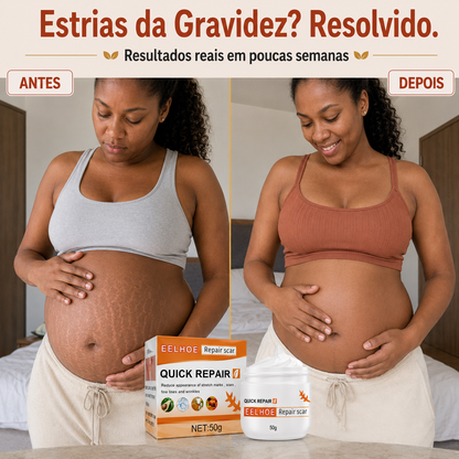 DermaRegen™ — Creme Regenerador de Pele para Cicatrizes, Estrias e Varizes