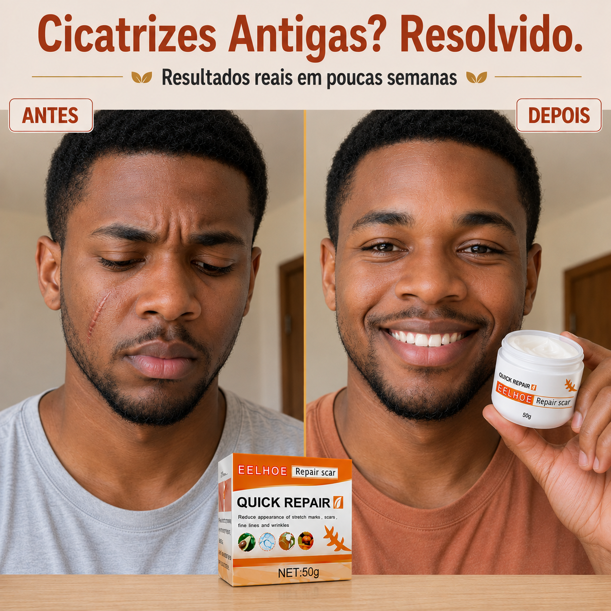 DermaRegen™ — Creme Regenerador de Pele para Cicatrizes, Estrias e Varizes