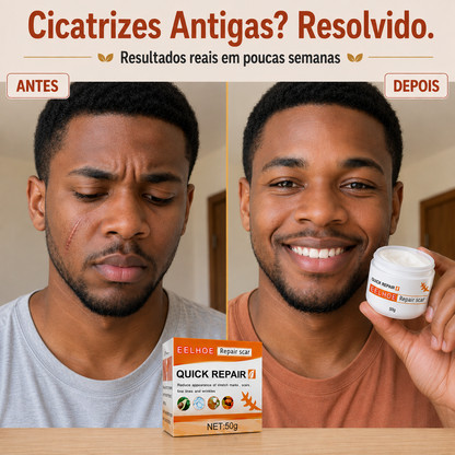 DermaRegen™ — Creme Regenerador de Pele para Cicatrizes, Estrias e Varizes